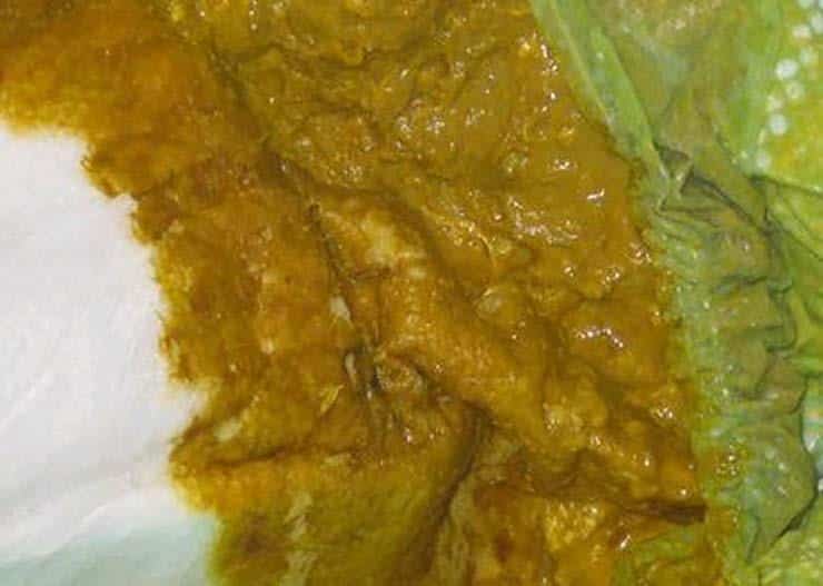 براز أصفر مع أخضر