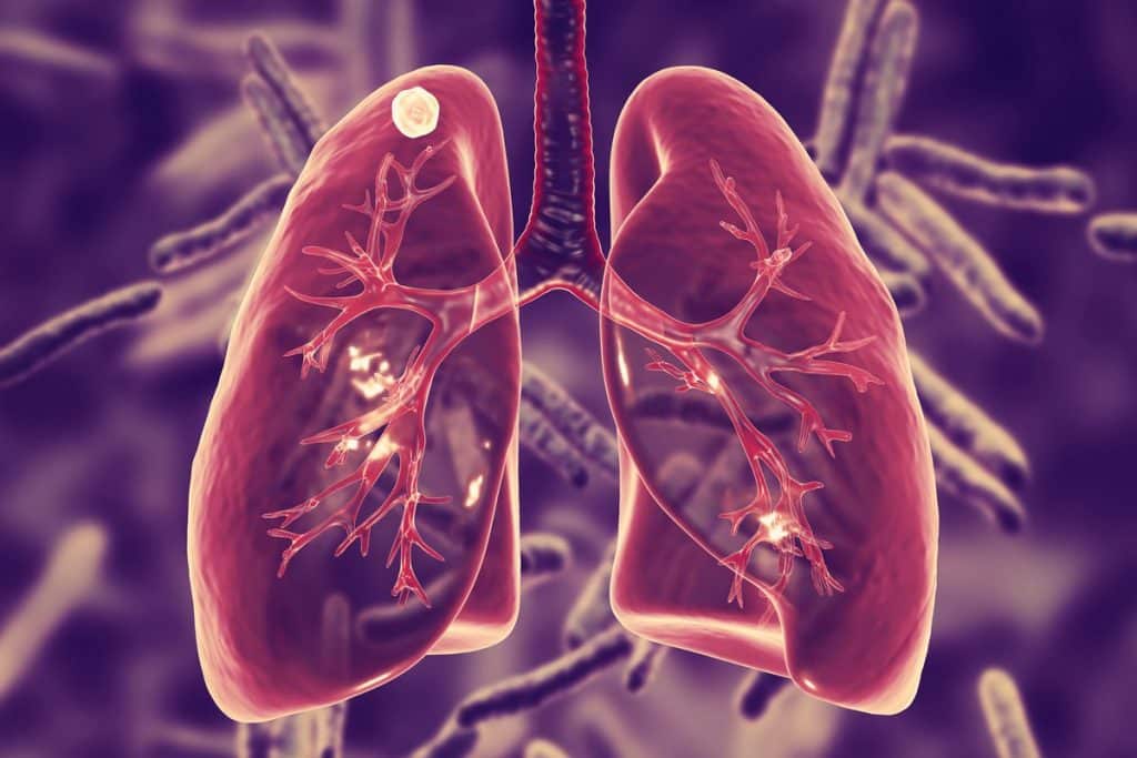 طريقة استخدام علاج الدرن