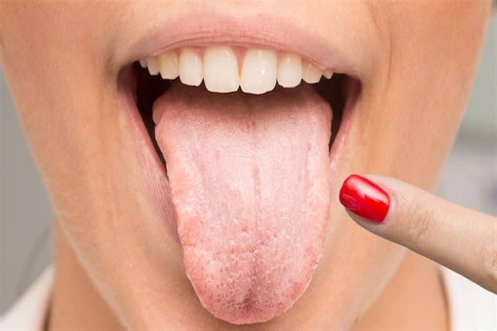 علامات الشفاء من الكانديدا