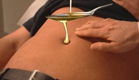 تجربتي مع وضع العسل على السرة