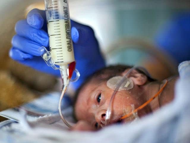تجربتي مع نزيف الدماغ للخدج
