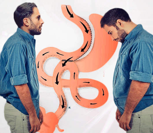 تجربتي مع عملية الساسي