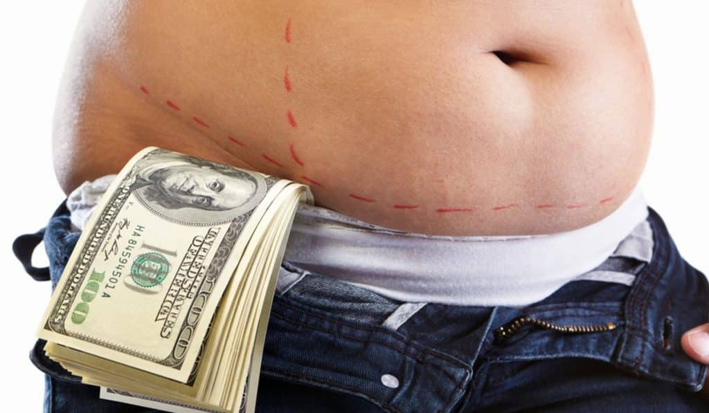 سعر عملية شفط الدهون