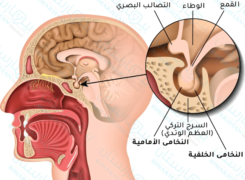 دواء لعلاج ورم الغدة النخامية