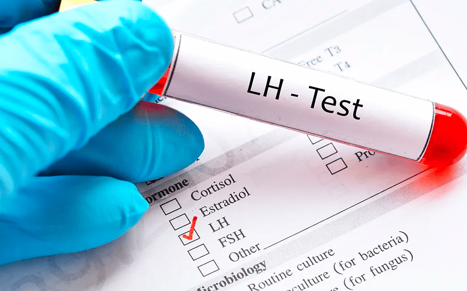 تجربتي مع هرمون LH
