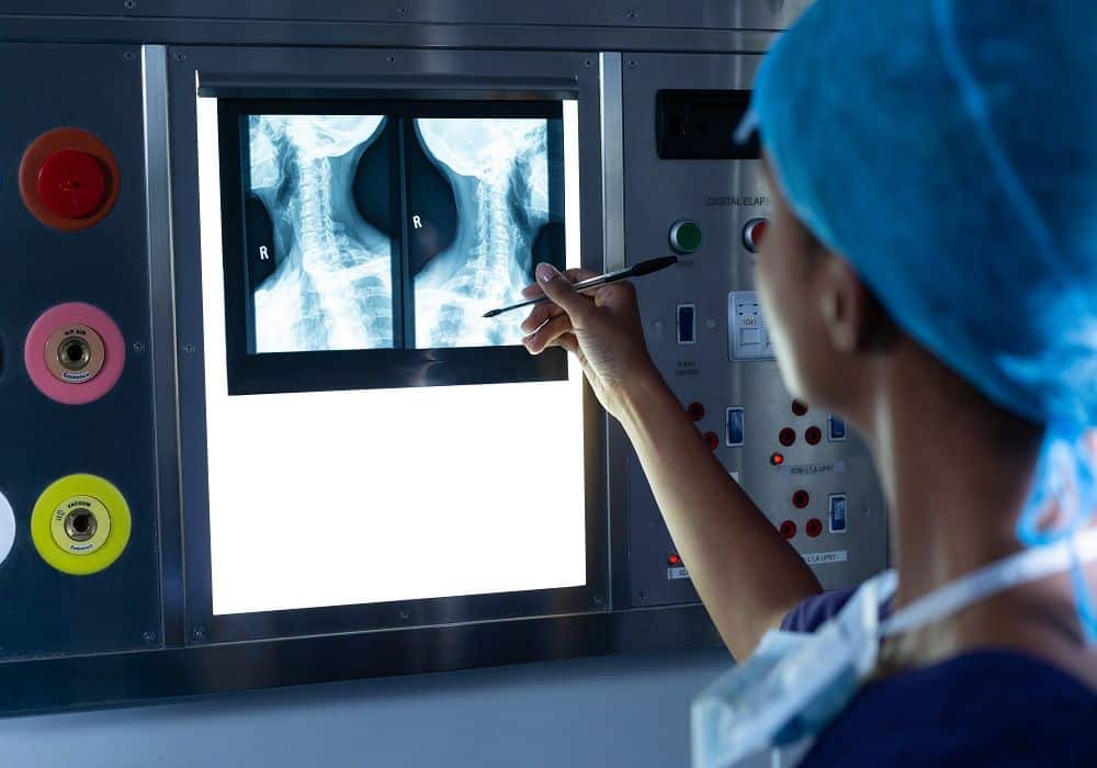 أضرار أشعة هشاشة العظام