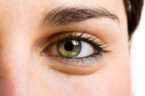 سبب ظهور خطوط تحت العين في سن العشرين