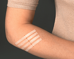 كيفية استخدام steri strip