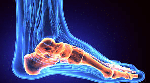 What do you have to do if you have 
 2 a rough knee?