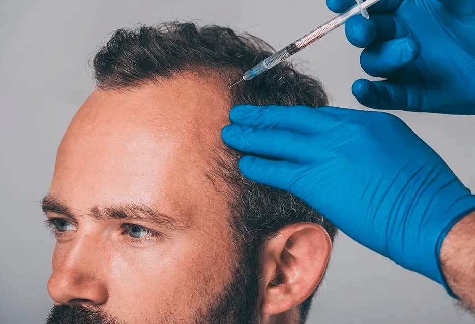 افضل عيادة لعلاج تساقط الشعر في مسقط