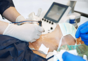 معلومات عن عملية الغدة الدرقية